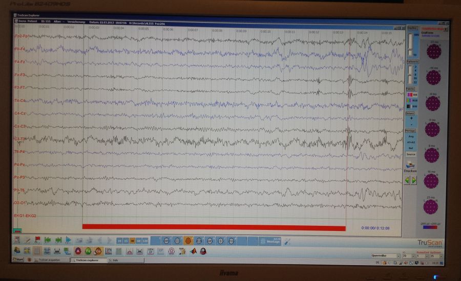 Neurofeedback_Trainingsscreen_EEG.jpg